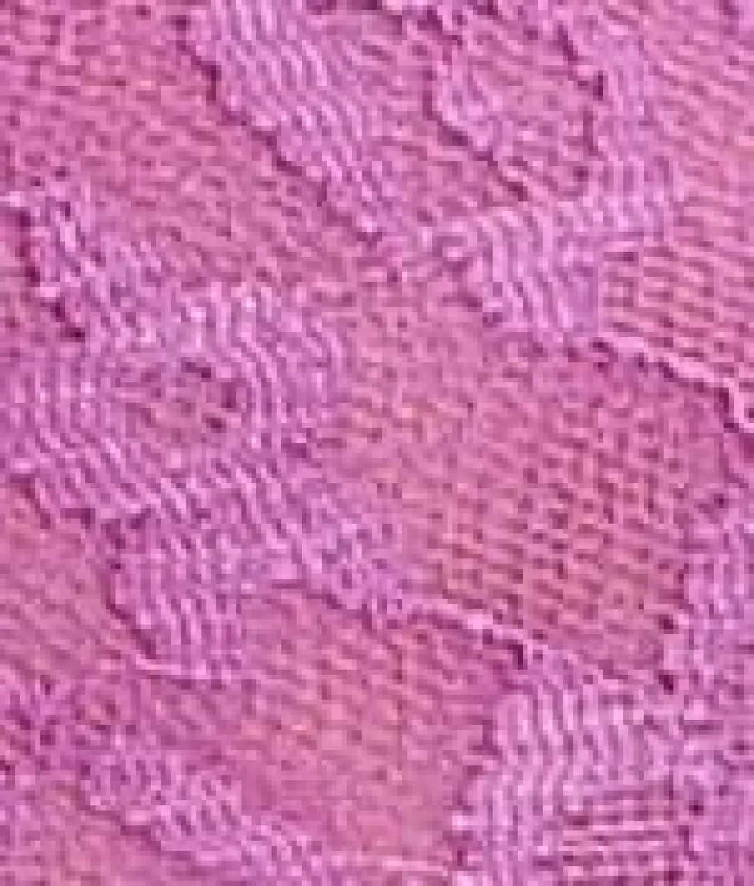 Allover Lace Bikini