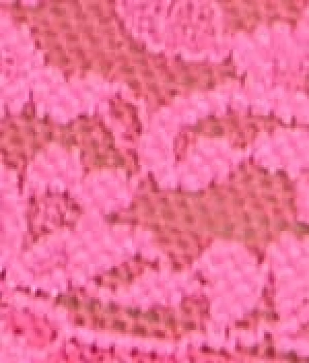 Signature Lace V-Kini